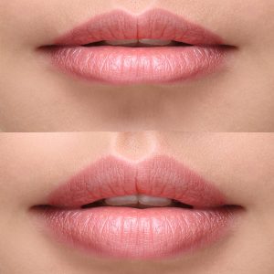 Part,Of,Face,,Young,Woman,Close,Up.,Sexy,Plump,Lips